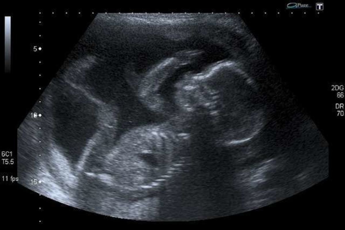 Фото малыша в 20 недель беременности